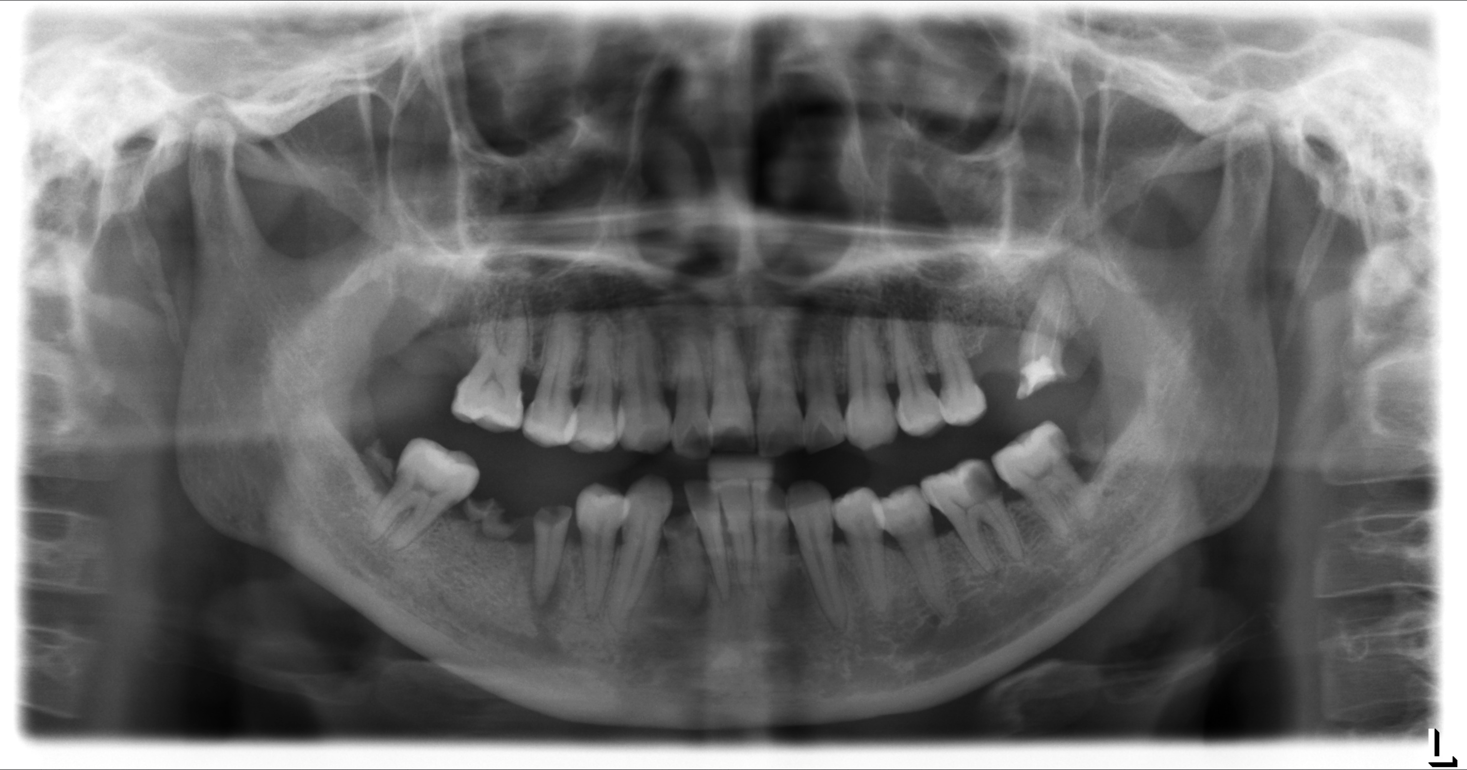 Dashboard d'imagerie — vue brute